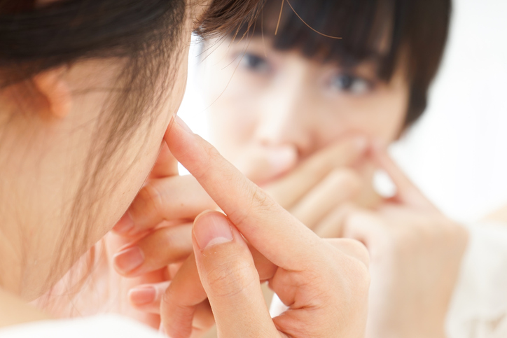 ニキビを悪化させずに隠したい（写真:iStock）