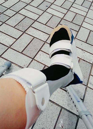 こんな装具を3カ月くらいつけてました（C）コクハク