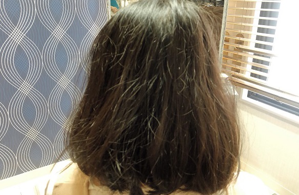 beforeがひどすぎるのだが…（C）コクハク