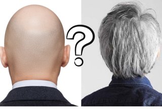 結婚するならハゲと白髪どっち？浮気する可能性が高いのは？