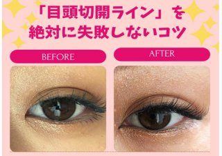 目頭切開ラインが人気!マル秘テク4つでマンバギャル回避