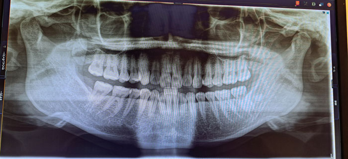 噛み合わせがビミョーに悪い（C）コクハク