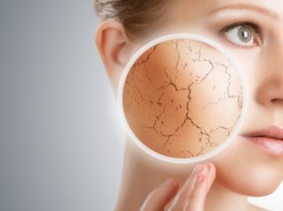 肌の砂漠化を回避しよう（写真:iStock）