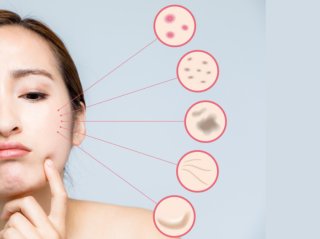 夏の終わりの肌トラブル、放置プレーしてない？日焼け・毛穴・乾燥ケアを