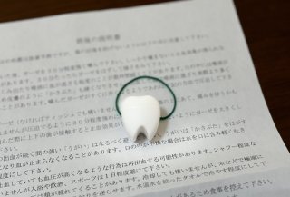 恐怖の親知らず抜歯！30女が超ビビりながら人生初抜歯した話