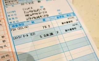 生理が来ない47歳女、婦人科で「閉経診断」。更年期の揺らぎって何?