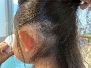 3歳娘にアタマジラミ!? 我が家を救ったアナログな退治法と意外な美容家電