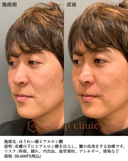 （イートップクリニック提供／無断転載禁止）