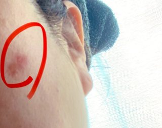 マスク生活で惰性の肌ケア→顔イボ発症! “老人性”の言葉にショック。こりゃあかん…50代目前で決意したこと